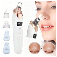 Electric Blackhead Vacuum Remover – Pore Cleanser & Pimple Sucker with Suction Technology for Deep Cleaning, Spa-Quality Facial Treatment, Gentle & Rechargeable for Home Use