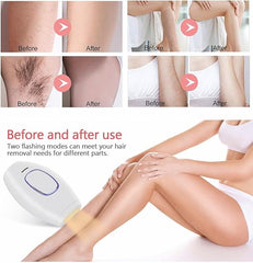 Home Use IPL Beauty Device – Painless Permanent Hair Removal System for Whole Body