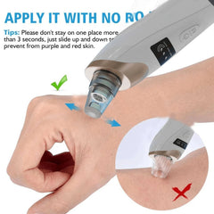 Electric Blackhead Vacuum Remover – Pore Cleanser & Pimple Sucker with Suction Technology for Deep Cleaning, Spa-Quality Facial Treatment, Gentle & Rechargeable for Home Use