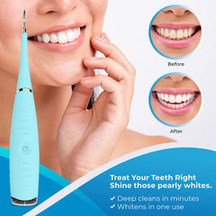 Electric Dental Calculus Remover – Sonic Tooth Tartar & Plaque Removal Kit, Safe Stain Cleaner for Adults & Kids – Multi-Speed Oral Care Tool