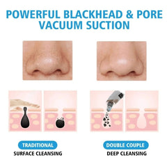 Electric Blackhead Vacuum Remover – Pore Cleanser & Pimple Sucker with Suction Technology for Deep Cleaning, Spa-Quality Facial Treatment, Gentle & Rechargeable for Home Use