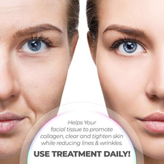 7-LED Whitening Face Mask | Advanced Optical Therapy Skin Care Device | Rejuvenating Light Treatment Mask for Glowing, Radiant Skin (White/Black, 230x200mm)