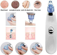 Blackhead & Whitehead Remover Electric Facial Beauty Machine – Deep Pore Cleansing Vacuum with Adjustable Suction, Rechargeable Skincare Tool for Smooth, Clear & Healthy Skin