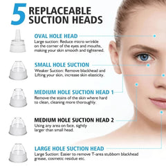 Electric Blackhead Vacuum Remover – Pore Cleanser & Pimple Sucker with Suction Technology for Deep Cleaning, Spa-Quality Facial Treatment, Gentle & Rechargeable for Home Use