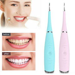 Electric Dental Calculus Remover – Sonic Tooth Tartar & Plaque Removal Kit, Rechargeable Stain Cleaner, Safe Oral Care Device for Kids & Adults (Multi Color)