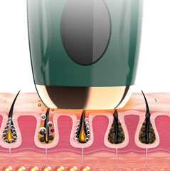 IPL Hair Removal Device – At-Home Painless Laser Hair Remover for Men & Women | Full Body Hair Reduction for Face, Bikini, Legs, Arms, & Underarms